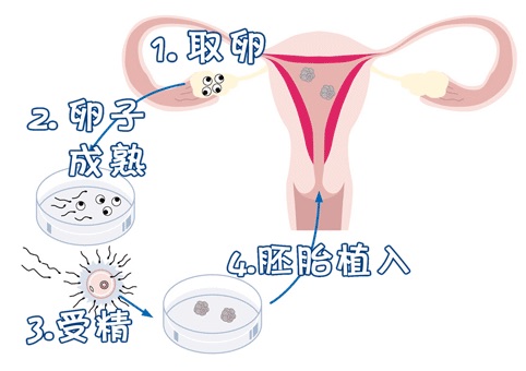 针灸